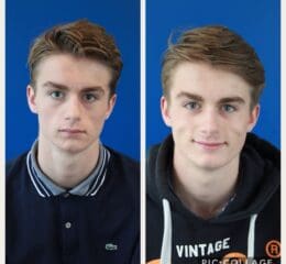Twee portretfoto's van dezelfde jongeman, voor en na een transformatie.